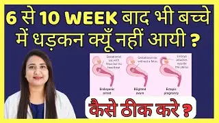 6 से 10 WEEK बाद भी बच्चे में धड़कन क्यूँ नहीं आयी ? कैसे ठीक करे ? BABY HEARTBEAT IN PREGNANCY