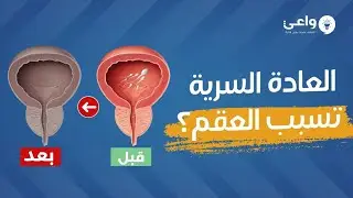 هل العادة السرية تسبب العقم؟ الحقيقة الصادمة عن تأثيرها على الخصية والإنجاب!