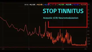 Stop Tinnitus Buzzing in 30min, TRT - tinnitus treatment