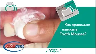 Как наносить Tooth Mousse? #toothmousse #гигиеназубов #детскаястоматология