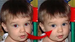 Red Eye removal in Photoshop|Red eye remove tool