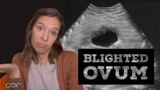 What is a blighted ovum/ anembryonic pregnancy? Explained by a genetic counselor