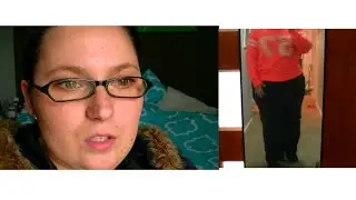 Part 6 - Left Total Hip Replacement of a 28yr old ● Perthes Disease