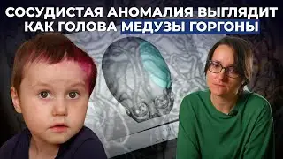 АРАХНОИДАЛЬНАЯ КИСТА, АРТЕРИОВЕНОЗНАЯ МАЛЬФОРМАЦИЯ | История Максима Саушкина