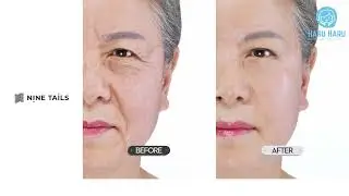 Nine Tails - Advanced Line Lift Serum (user 1) | HaruTube