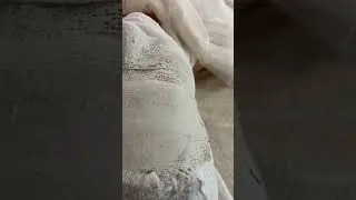 Молодость БЕЗ уколов ❤️ Пептидное армирование лица 🔥 