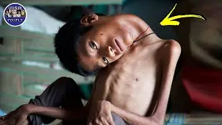 5 UNUSUAL PEOPLE IN THE WORLD PART 241