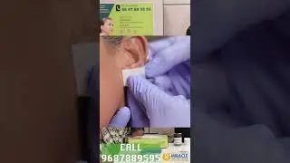 Ear lobe repair kaise kare👂👂 | ear pasting Treatment | कान के बढ़े हुए छेद बंद करें | #piercing