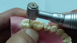 اتعلم تريكات ال cavity preparation وازاى تعمل كلاس ١ بكل سهوله / preparation of class 1 lower 7