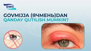 Govmijja (Ячмень) dan qanday qutilish mumkin?  