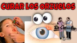 Orzuelo 👁 | ¿Tienen Cura?