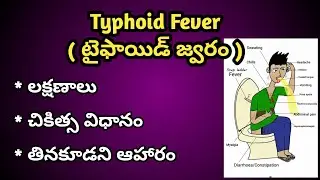 Typhoid Fever Symptoms and Treatment in Telugu ( టైఫాయిడ్ జ్వరం లక్షణాలు,చికిత్స విధానం )