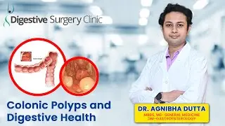 𝐃𝐫. 𝐀𝐠𝐧𝐢𝐛𝐡𝐚 𝐃𝐮𝐭𝐭𝐚 on Colonic Polyps and Digestive Health | Digestive Surgery Clinic