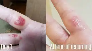 Katy's Shingular Testimonial