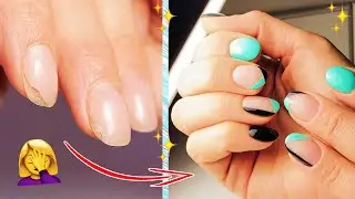 Отслойки на ногтях / Коррекция / Простой и Яркий дизайн ногтей