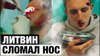 ЛИТВИН СЛОМАЛ НОС/ЛИТВИНУ ВЫПРЕМЛЯЮТ НОС