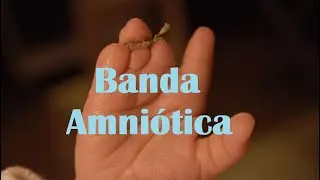 Banda amniótica del embarazo