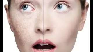 Photoshop tutorial: face retouching, make smooth skin and remove pimple, acne, blemishes.