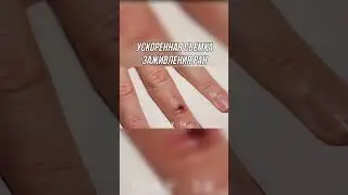 Ускоренная съемка заживления ран 😲 