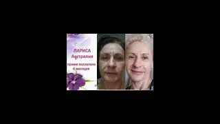 Результаты применения МОРСКОГО КОЛЛАГЕНА