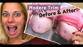 Modere Trim Before and After pictures
