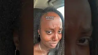Not all hairstyles are for everyone 💇‍♀️💈#hair #before