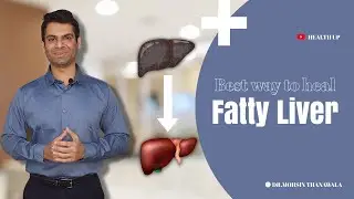 How to Beat Fatty Liver Naturally