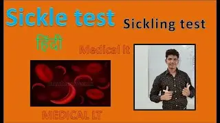 sickle test || sickling test || sickle test in hindi