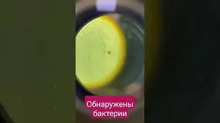 бактерии в моче под микроскопом! 