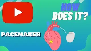How Does A PACEMAKER Work