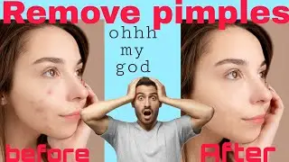 Remove pimples and black mark from face.😯