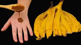 Banana Peel Erases All Wrinkles on Your Face! 100-Year-Old Recipe! Top Banana Recipes!