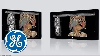 Centricity Universal Viewer Zero Footprint | GE Healthcare