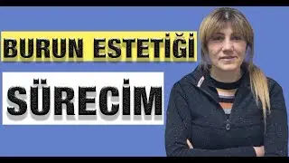 Burun Estetiği Sürecim !!