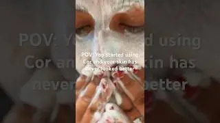 If you haven’t tried it yet … what are you waiting for? #clearskin #noacne