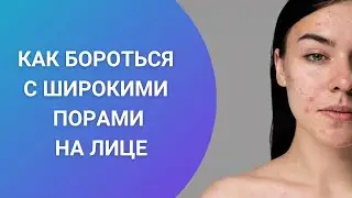 КАК БОРОТЬСЯ С ШИРОКИМИ ПОРАМИ НА ЛИЦЕ
