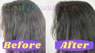 Premature Grey Hair | Home Remedies for Gray Hair | Reverse Gray Hair | White Hair Problem | Remedy