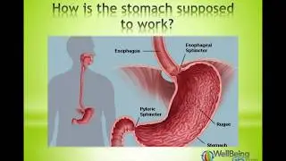 Reflux & GERD // WellBeingGPS.com