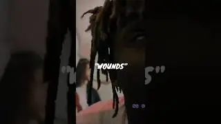 [Free] Juice WRLD Type Beat 2023 - Wounds #juicewrldtypebeat #juicewrldtypebeat2023 #shorts
