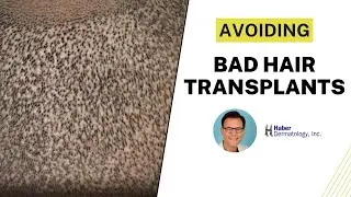 Black Market Hair Transplants  | Robert Haber, MD