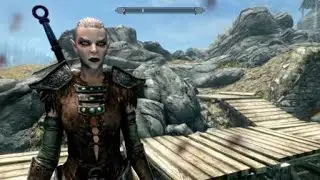 Half Elf Goes on sporadic murder spree!!!