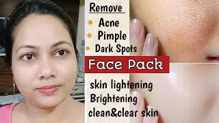 3 Days Challenge for Glowing & Brightening Skin | Home made Face Pack for Skin whitening | Face Mask
