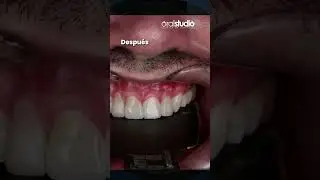 Si sueñas con mejorar tu sonrisa, ¡estás en el lugar correcto! Contáctanos hoy al 📞 312 709 3687