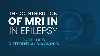 The contribution of MRI in Epilepsy | Part 1 Differential Diagnosis