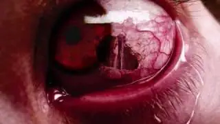 unterart-the_antagonist