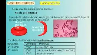 Genetics Part 5: Human Genetic Disorders