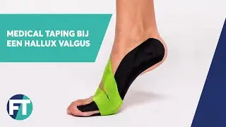 hallux valgus tapen | Medical Taping | FysioTape