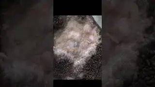 Elephantiasis Nostras Verrucosa