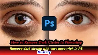 how to remove dark circles using photoshop|skin retouching|remove eye bags Photoshop