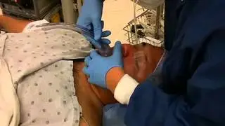 Laryngeal Mask Airway in Medical Emergencies NEJM